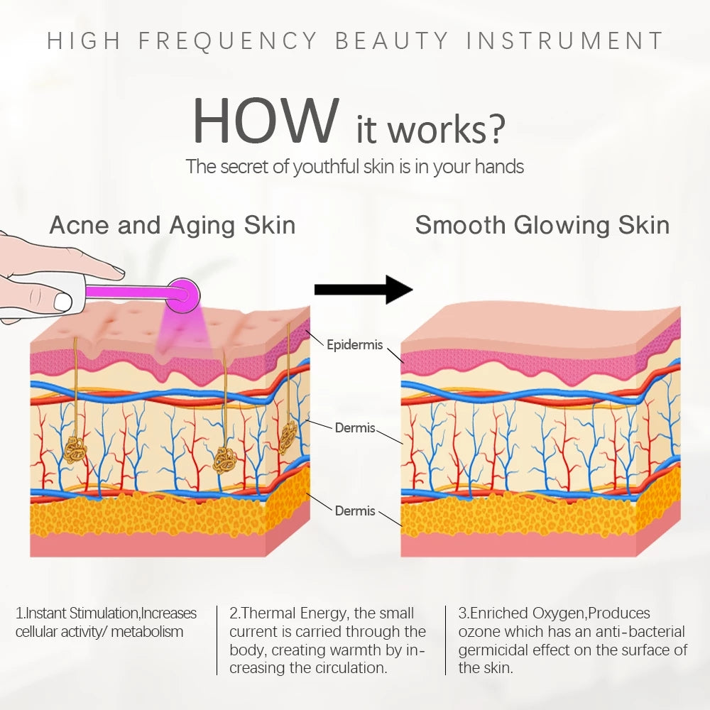 4-in-1 High Frequency Violet Ray Wand for Acne Treatment