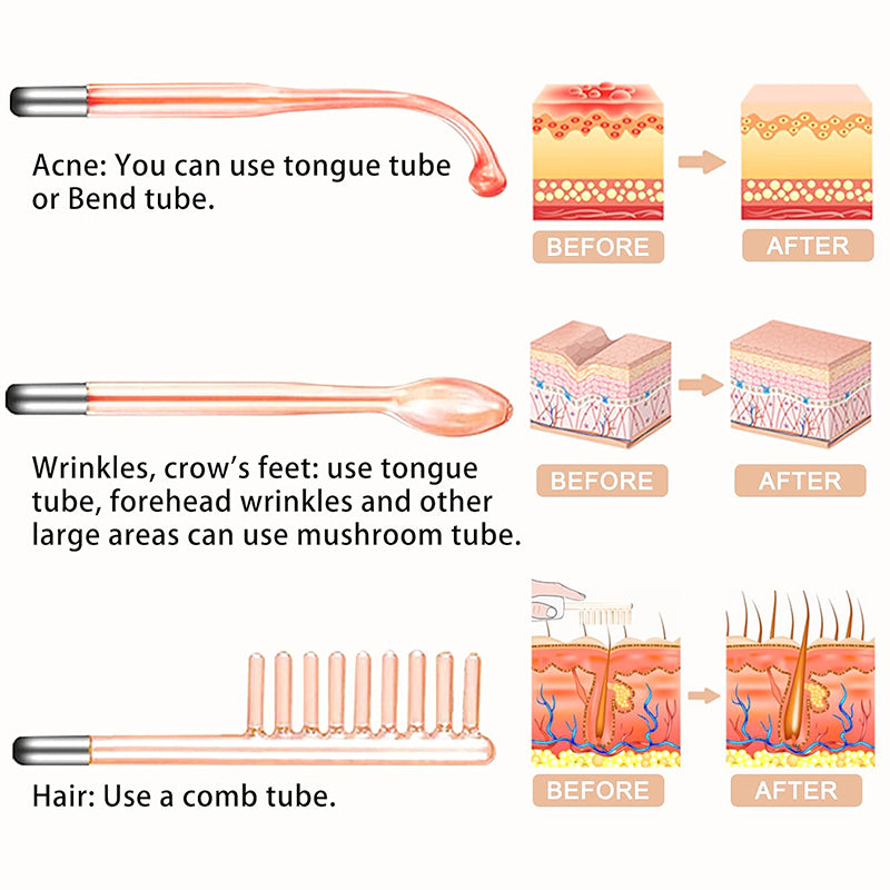 4-in-1 High Frequency Violet Ray Wand for Acne Treatment